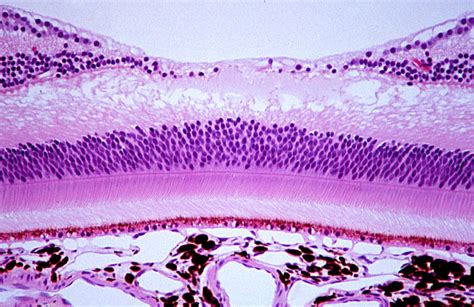 Fovea Histology