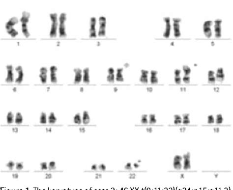 Figure 1 From The Impact Of Variant Philadelphia Chromosome Translocations On The Clinical