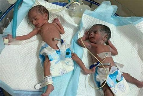 74 yr old andhra woman gives birth to twins odishabytes