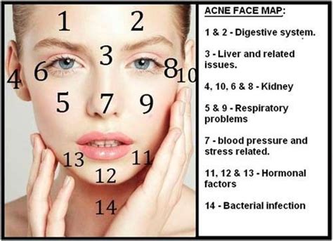 How To Get Rid Of Forehead Acne Causes And Prevention Tips Health