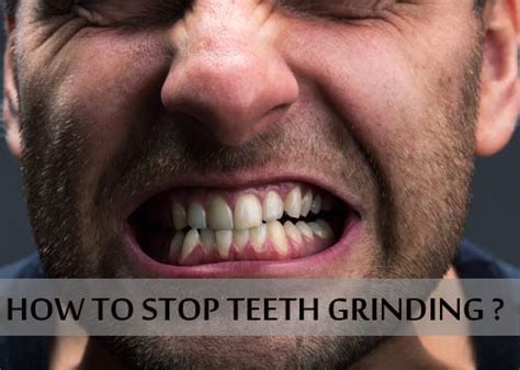 This in turn is usually caused by stress or chronic habits teeth grinding: How To Stop Grinding Teeth While Sleeping ...