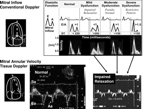 A Clinicians Guide To Tissue Doppler Imaging Circulation