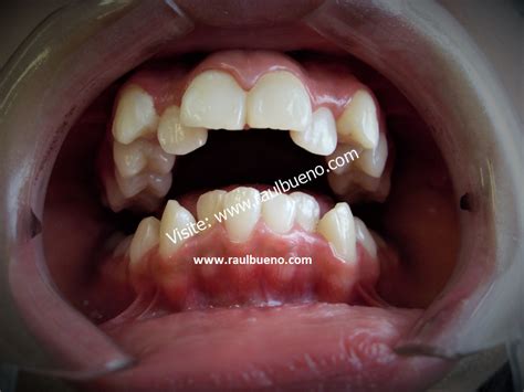 Compresión Transversal Clínica De Especialidad Odontológica Del Dr