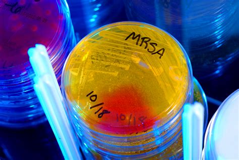 Methicillin Resistant Staphylococcus Aureus Mrsa Vermont Department