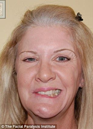 Mary Jo Buttafuoco Left Disfigured After Being Shot In Face Raises