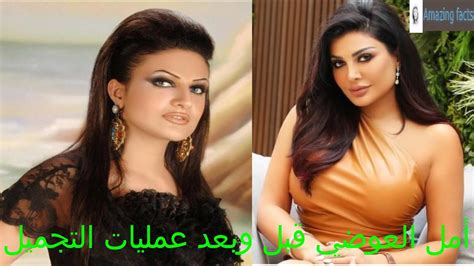 أمل العوضي قبل وبعد عمليات التجميل ، Actress Amal Al Awadi Before And After Plastic Surgery