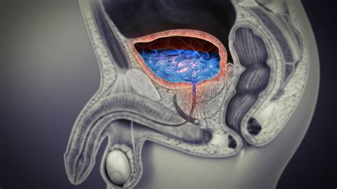 Understanding Utis In Men Rare But Complicated Scientific Animations