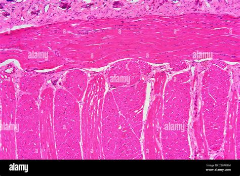 Muscle fibers micrograph fotografías e imágenes de alta resolución Alamy