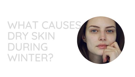 What Causes Dry Skin During Winter Dermaworks