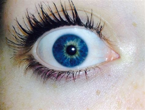This trait usually involves both eyes. Central Heterochromia | Central heterochromia, Eye ...