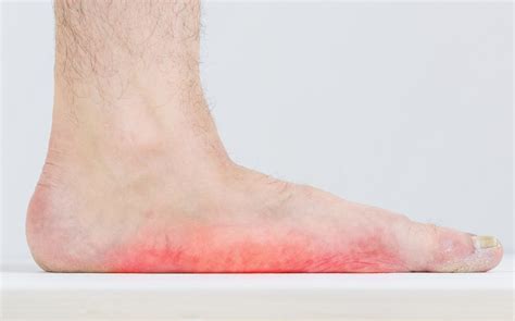 How Do Flat Feet Affect Your Overall Health Hammburg