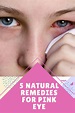 5 Natural Remedies for Pink Eye - Health & Fitness
