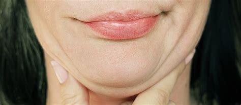 What Causes A Double Chin Causes And Treatment Options Atlanta Face