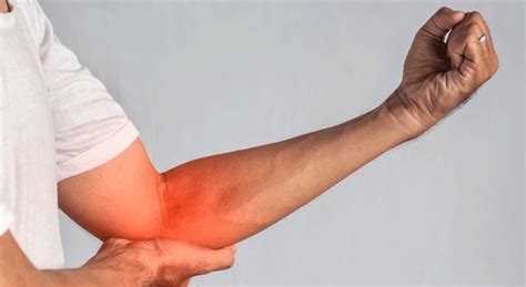 Cubital Tunnel Syndrome Signs And Treatment
