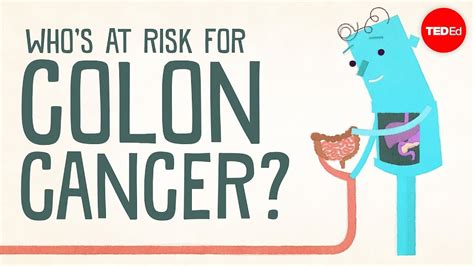 Whos At Risk For Colon Cancer Amit H Sachdev And Frank G Gress