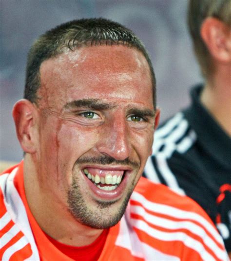 Ribéry began his footballing career with rc lens, as a member of their youth academy for 11 years. Franck-Ribery-Images-teeth | Key Topics in Restorative ...