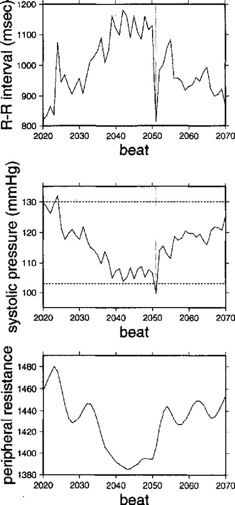 Figure 1 From A Cardiovascular Control Model Of 1f Fluctuations In