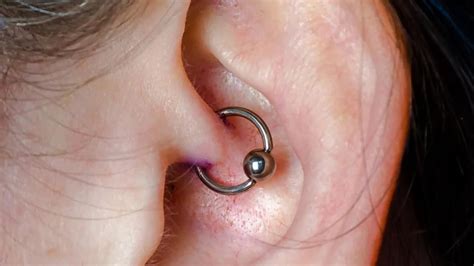 Daith Piercings For Migraines Do They Help And Alternative Treatments