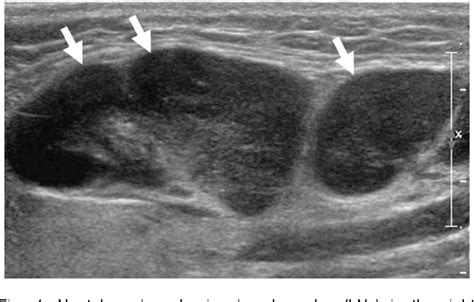 Figure 4 From Ultrasound Based Diagnosis For The Cervical Lymph Nodes
