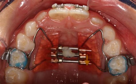 Simple Science: How to Make a Volcano with Kids