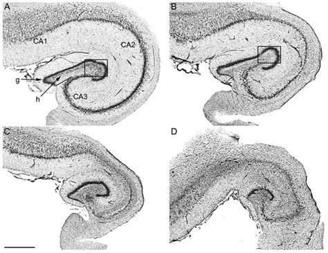 The Neurocritic Hippocampal Pathology In California Sea Lions With
