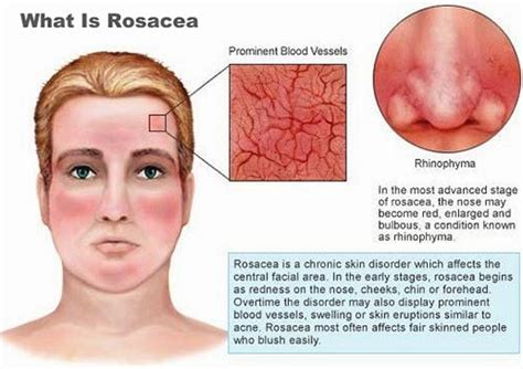 Dermatology Most Common And Most Severe Conditions And Its