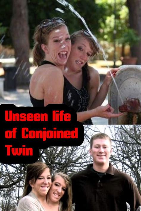 Born On March 7th 1990 In Carver County Minnesota Abigail Loraine Hensel And Brittany Lee
