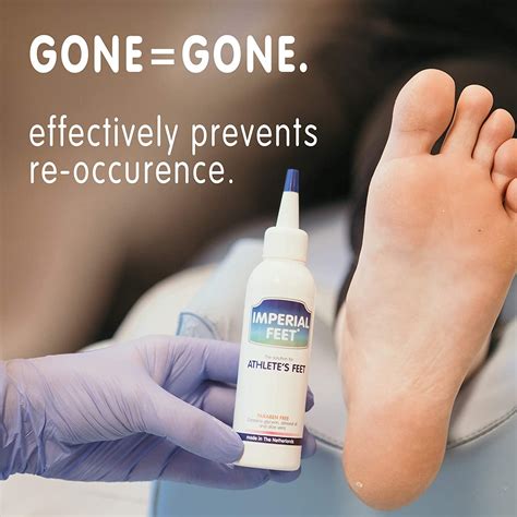 Powerful Athletes Foot Treatments Cream Anti Itch Cream Anti Fungal Foot Treatment