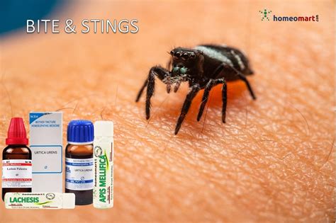 Insect Bite Swelling Treatment Homeopathy Remedies