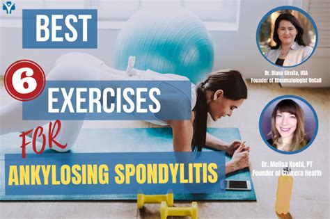 Best Exercises For Ankylosing Spondylitis At Home Rheumatologist