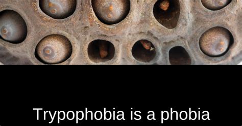 What Is Trypophobia Symptoms Causes Diagnosis Treatme