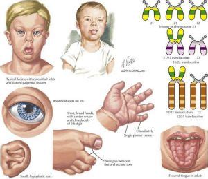 Dsi does world down syndrome day 2021. 21 maart Downsyndroomdag - STVS