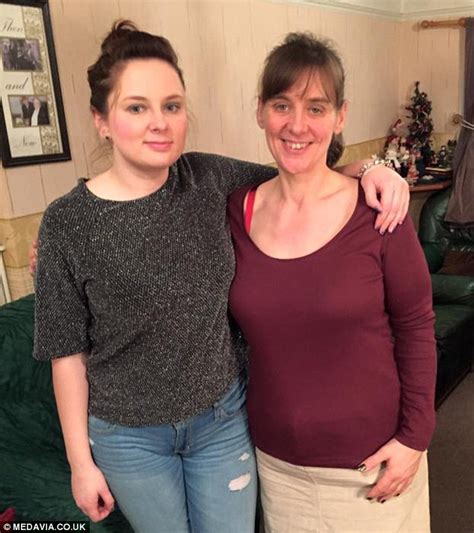 Mum Left With Huge Flap Of Saggy Skin After Losing 13st Begs The Nhs To