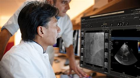 Philips Debuts Innovations In Ultrasound And Enterprise Informatics At