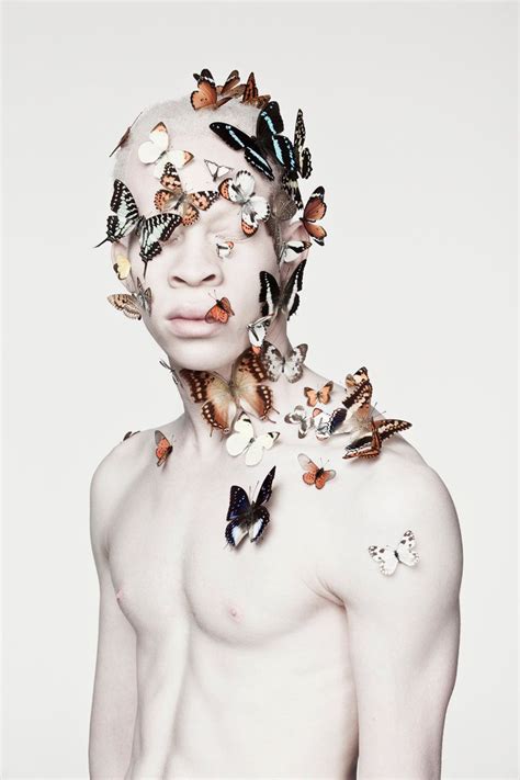 Stunning Photos Of Models With Albinism Capture The Beauty In Breaking