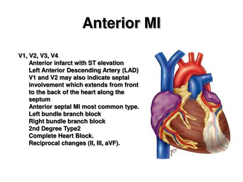 Ppt Myocardial Infarction Powerpoint Presentation Free Download Id