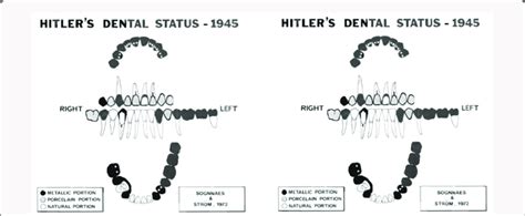 Hitlers Dental Status After Oral Information Collected From His Dental