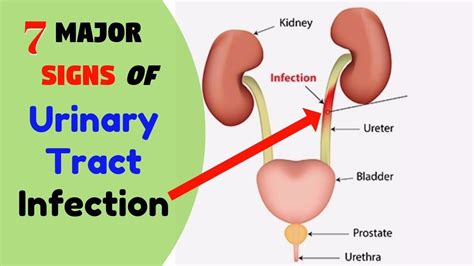 Major Symptoms Of Urinary Tract Infection Urinary Tract Infection