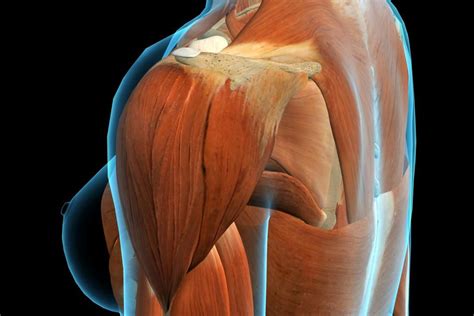 Deltoid Pain Causes Exercises And Relief Deltoid Muscle Pain
