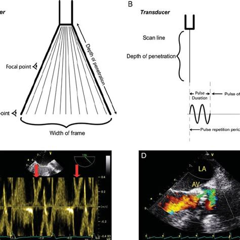 Pdf Resolution In Ultrasound Imaging