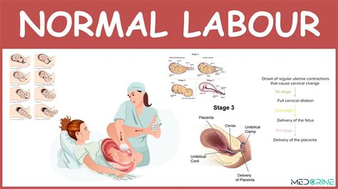 Physiology Of Normal Labour Stages Mechanisms And Management Youtube
