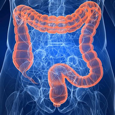 Diverticoli Cause Sintomi Cura E Prevenzione