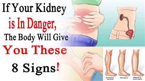 How To Detect Kidney Infection
