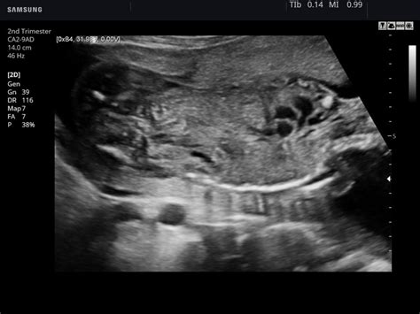 Ultrasound Images • Fetal Abdomen B Mode Echogramm №781