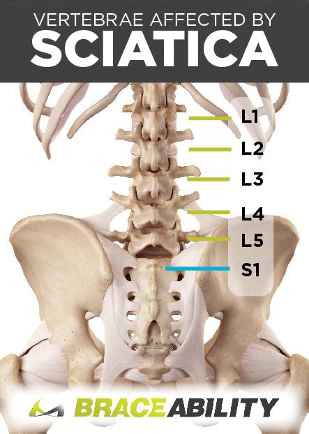 Sciatica And Pinched Nerve Pain Symptoms Causes And Lower Back Treatment