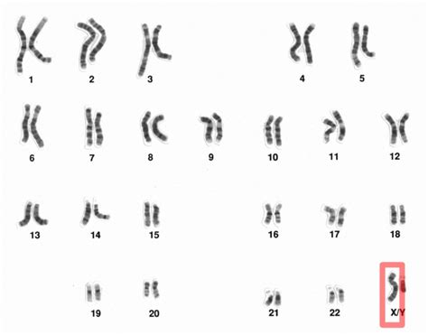 What Is The Difference Between Xx And Xy Chromosomes Pediaa