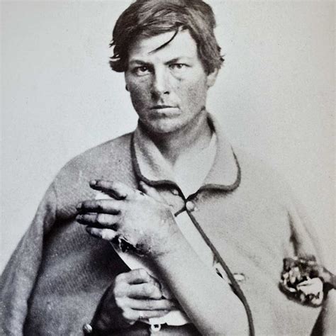 Wound Infection Man Of War Vintage Portraits Vintage Photos Civil