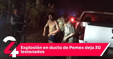 Explosión En Ducto De Pemex Deja 30 Lesionados Noticias24siete