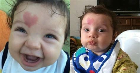 The Boy Who Was Born With A Birthmark In The Shape Of A Heart On His