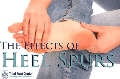 The Effects Of Heel Spurs Triad Foot Center Heel Spurs Foot